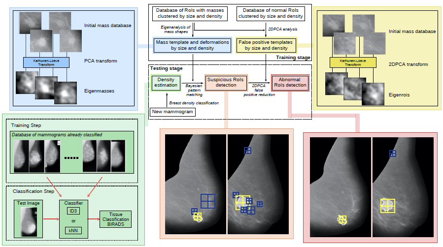 Computer-aided detection of masses in mammography