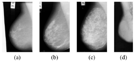 Mammograms of the four BI-RADS density categories