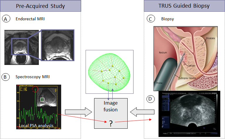 Prostate segmentation in MRI and ultrasound